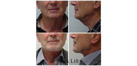 Dr. Michael Kreidstein Plastic and Cosmetic Surgery Clinic